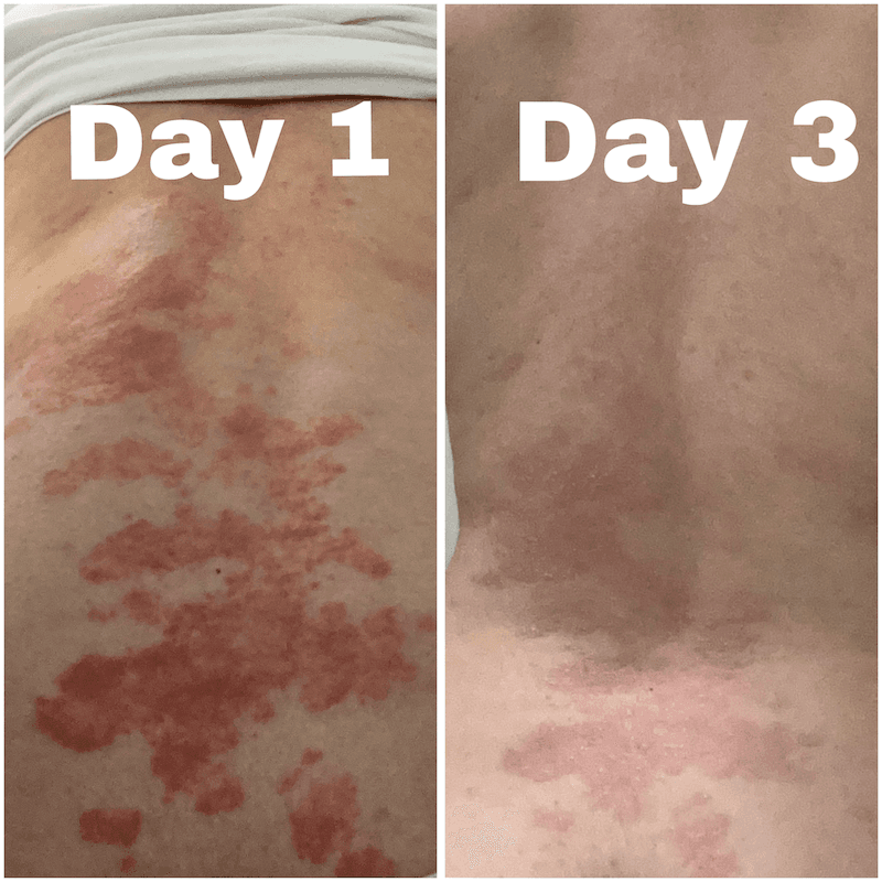 CBD Cream for dry, atopic and eczema-prone skin