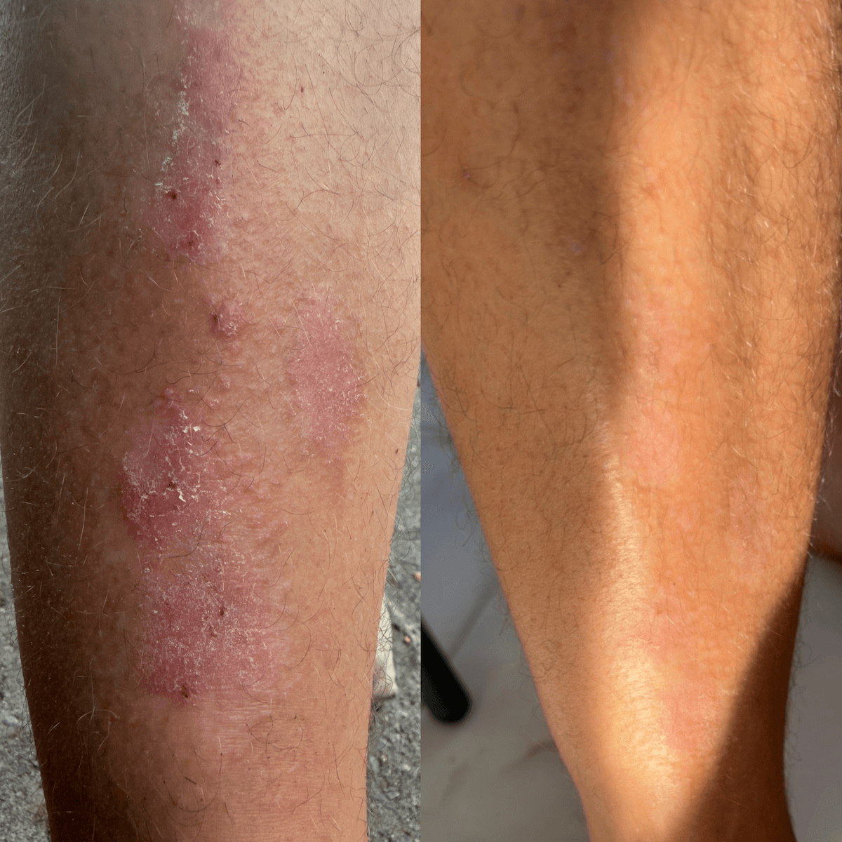 Restorative CBD Cream for Dry, Flaky and Psoriasis-prone skin